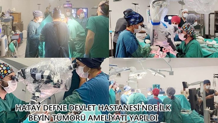 DEFNE DEVLET HASTANESİ’NDE İLK BEYİN TÜMÖRÜ AMELİYATI YAPILDI